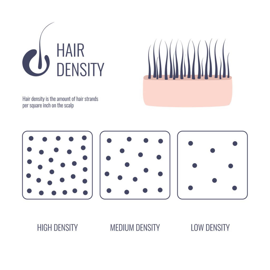 Image of hair density ranging from low to high density hair